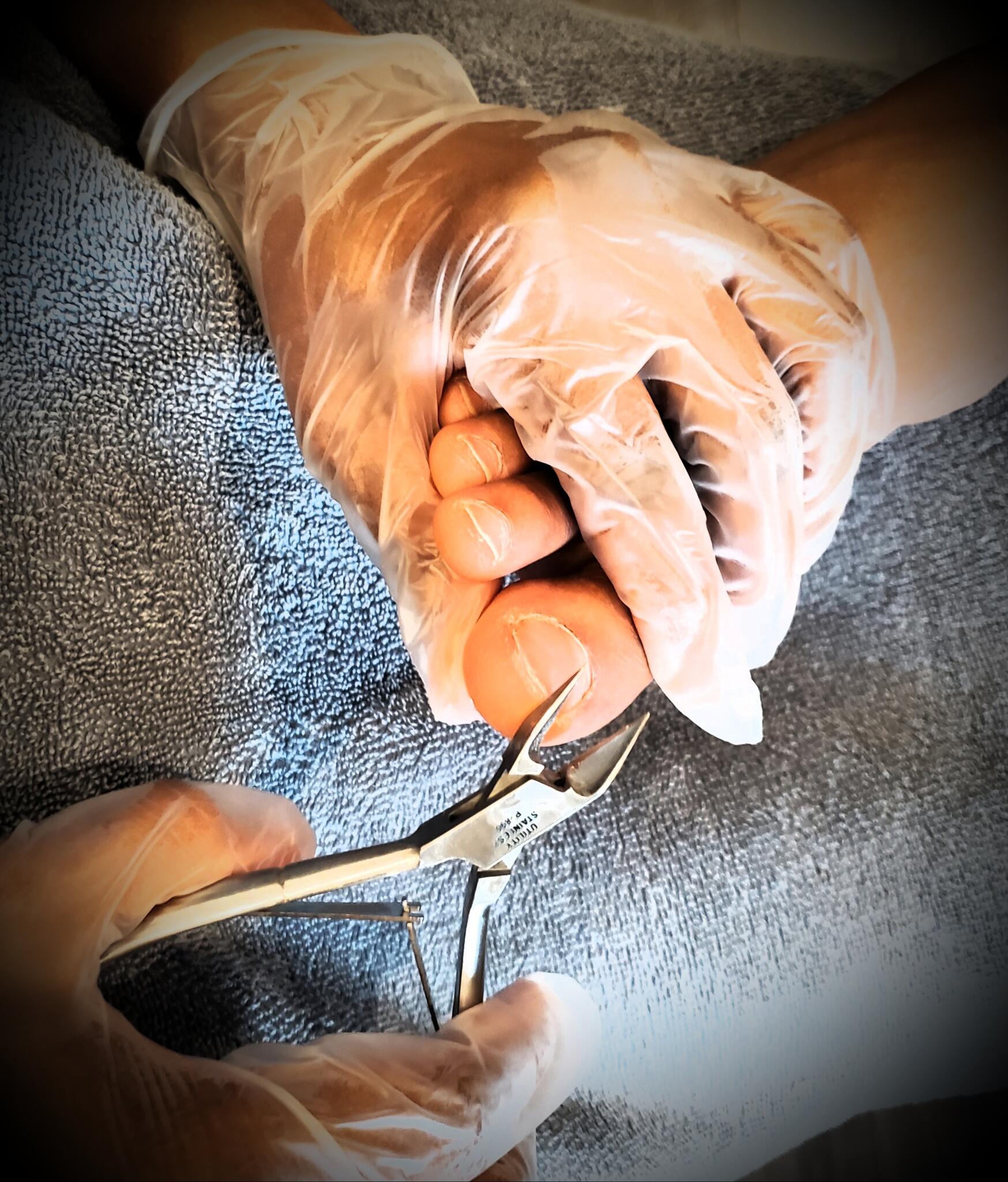 Lily Nursing Foot Care Saskatoon, Saskatchewan Nextdoor